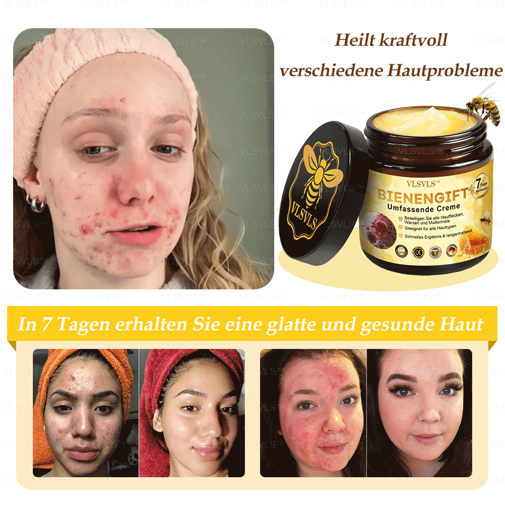 Hergestellt und versendet aus Deutschland  👑VLSVLS® Bienengift Hautregenerationscreme 🔥 LETZTER TAG 80 % RABATT
