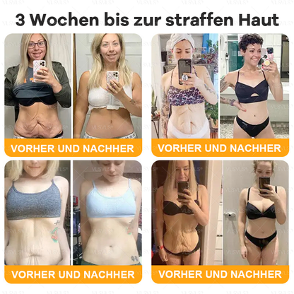 Hergestellt und versendet aus Deutschland  👑VLSVLS® Bienengift Hautregenerationscreme 🔥 LETZTER TAG 80 % RABATT