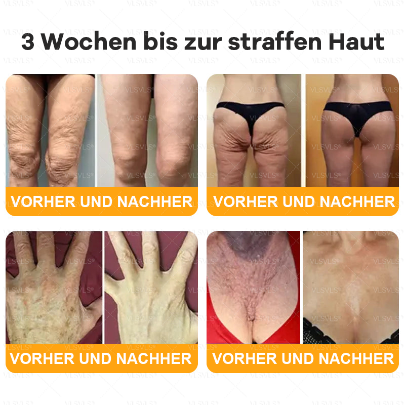 Hergestellt und versendet aus Deutschland  👑VLSVLS® Bienengift Hautregenerationscreme 🔥 LETZTER TAG 80 % RABATT