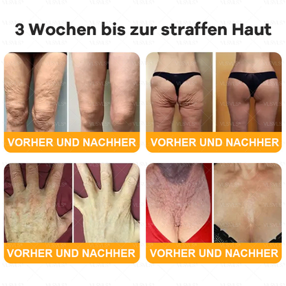 Hergestellt und versendet aus Deutschland  👑VLSVLS® Bienengift Hautregenerationscreme 🔥 LETZTER TAG 80 % RABATT