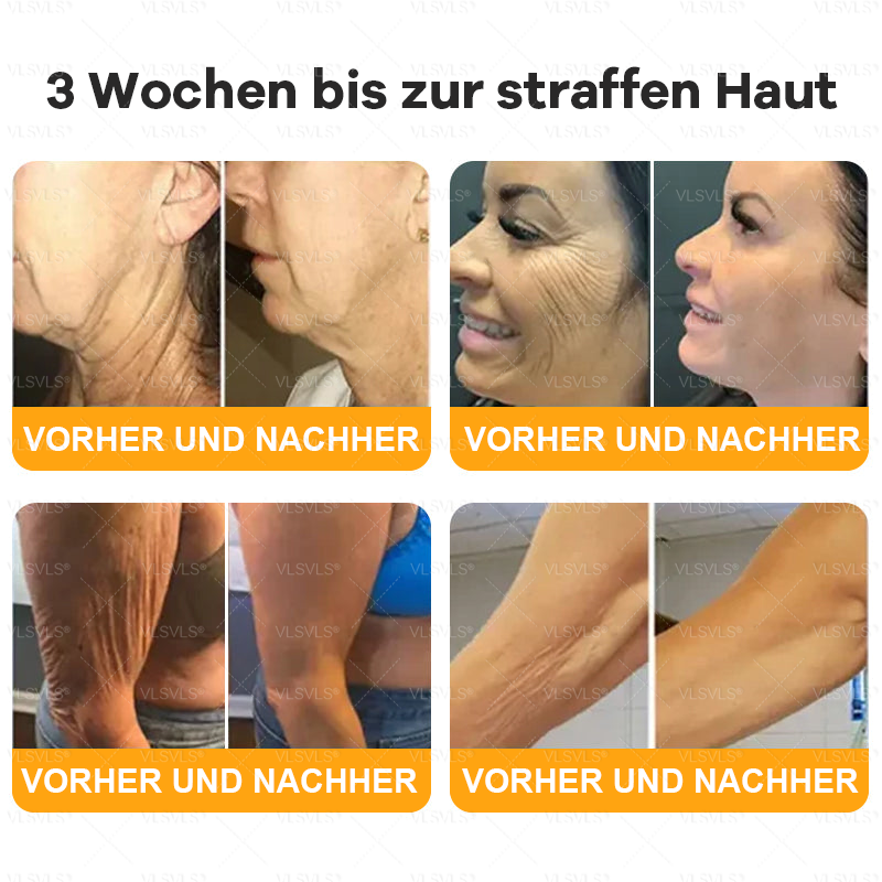Hergestellt und versendet aus Deutschland  👑VLSVLS® Bienengift Hautregenerationscreme 🔥 LETZTER TAG 80 % RABATT